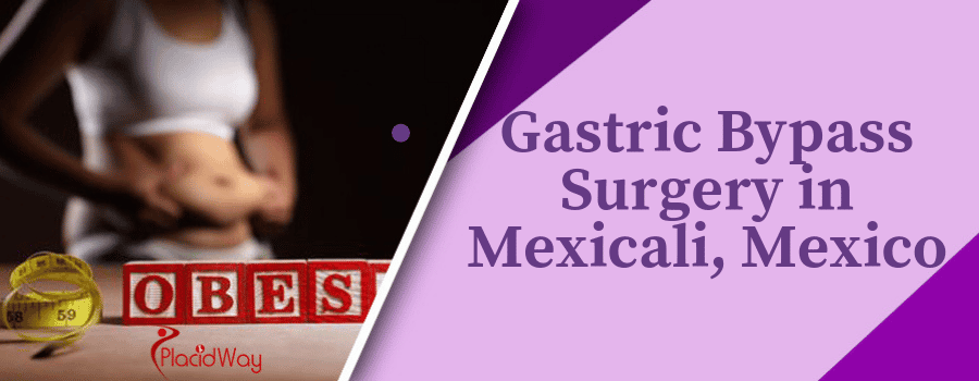 Gastric Bypass Surgery in Mexicali, Mexico